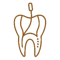Endodontic Treatment