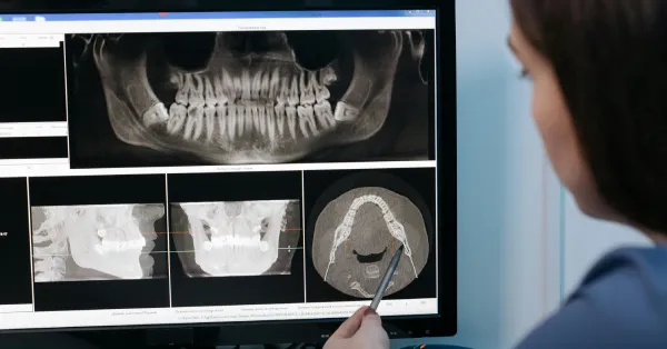 oral-medicine-radiology-in-chitradurga