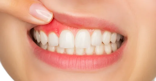 periodontics-in-chitradurga